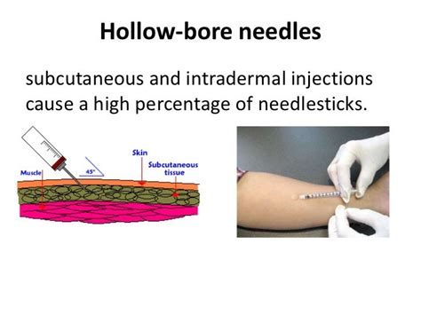 what is a hollow bore needle