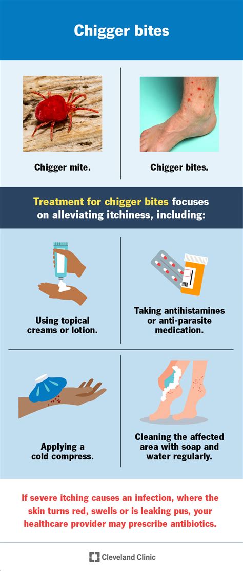 What Is A Jigger Bug Bite