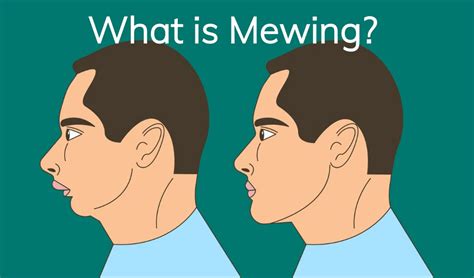 what is a mewing streak