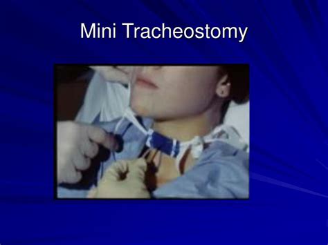 What Is A Mini Tracheostomy