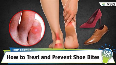 What Is A Shoe Bite
