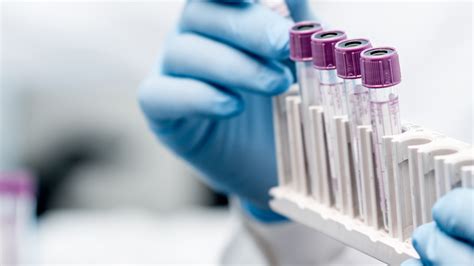 What Is A Specimen In A Lab