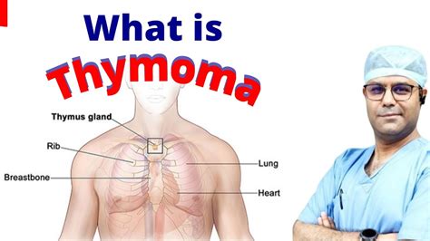 what is a thymoma tumor