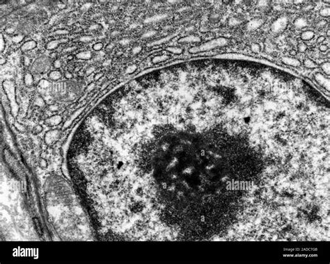 What Is A Transmission Electron Micrograph