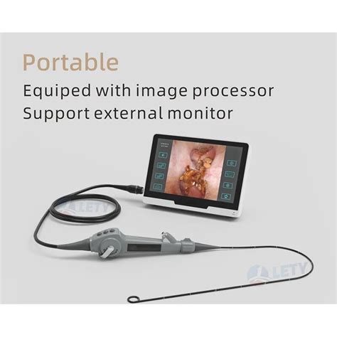 What Is A Urinary Scope