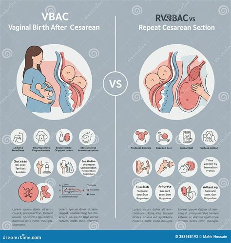 Understanding Your Options: What is a VBAC and Is It Right for You?