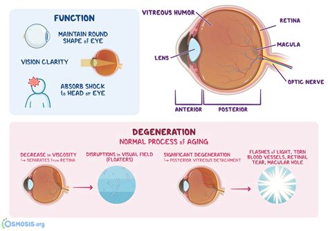 what is a vitreous humor