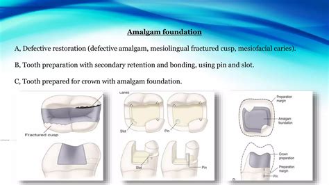 What Is Amalgam Process