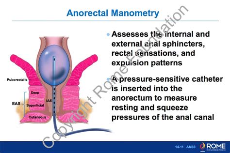 what is an anal manometry test