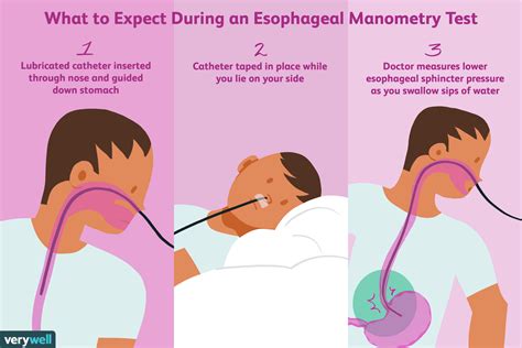 what is an esophagus test