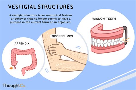 What Is An Example Of A Human Vestigial Structure