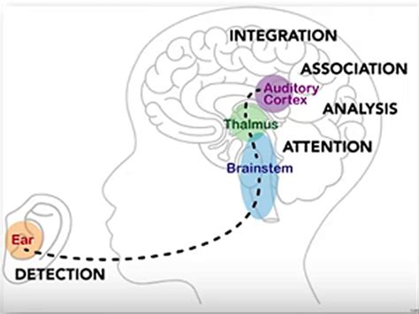 what is auditory processing in the brain