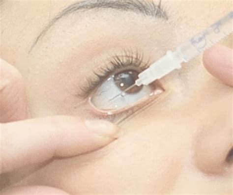 what is avastin eye injection