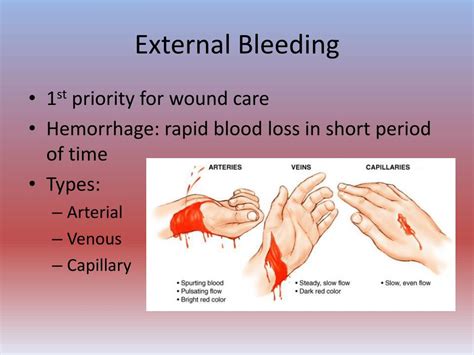 What Is Bleeding Shock