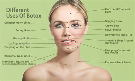 what is botox used for cosmetically