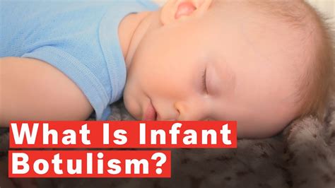 what is botulism in babies