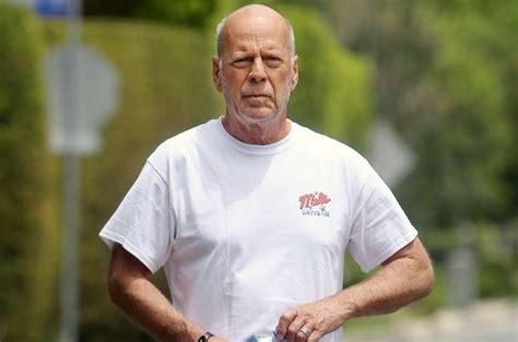 what is bruce willis current condition
