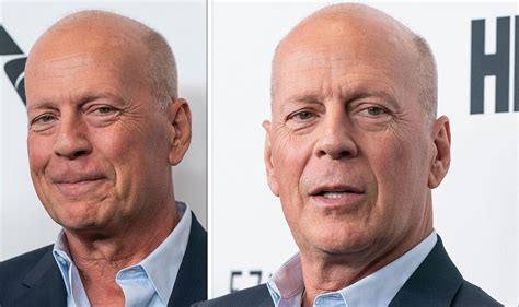 what is bruce willis medical condition