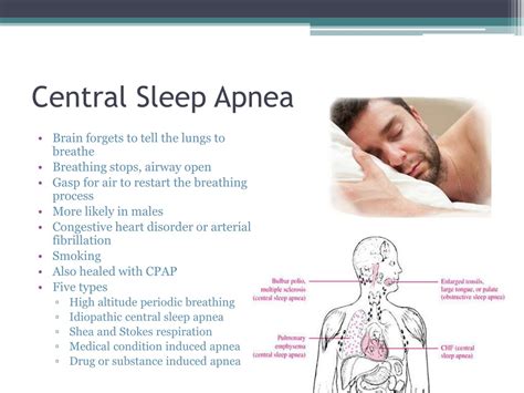 what is central sleep apnea