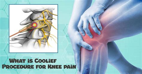 what is coolief for knees