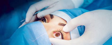 what is corrective eye surgery