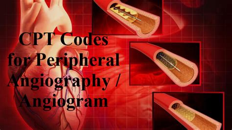 What Is Cpt Code Angiogram