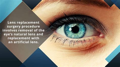 what is eye lens replacement surgery