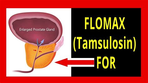 What is Flomax and What Does it Do Exactly?