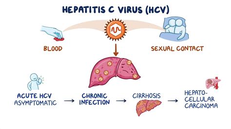Understanding What is Hep A: Causes, Symptoms, and Prevention