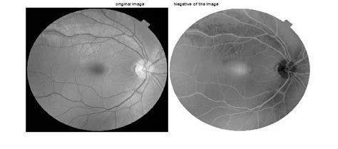 what is image negative transformation