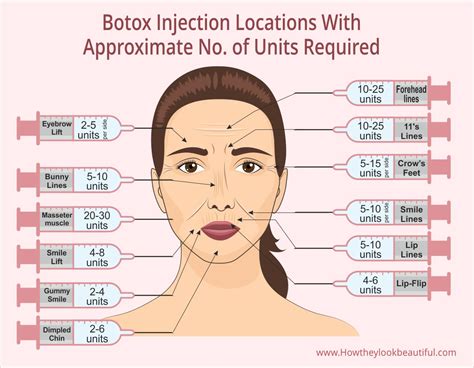 what is in botox injections ingredients