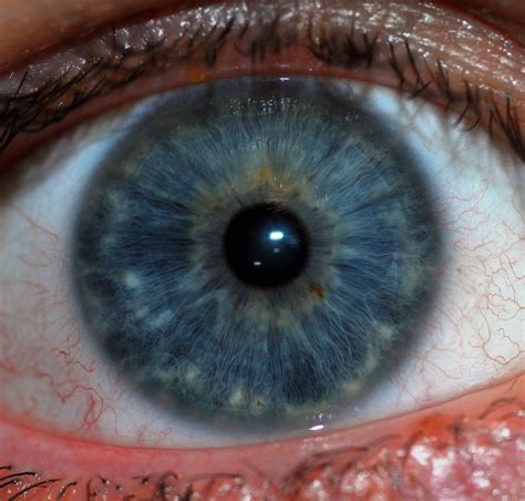 what is iris in the human eye