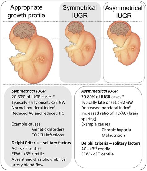 Understanding IUGR: Causes, Symptoms, and Treatment Options Explained