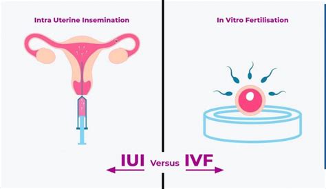 what is iui vs ivf