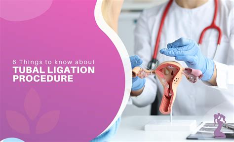 what is ligation in medical terms