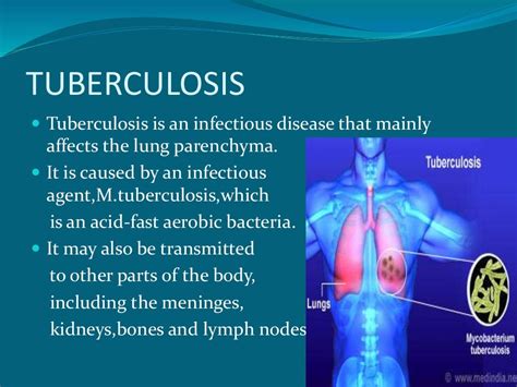 what is meaning of tb
