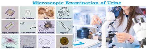 what is microscopic test