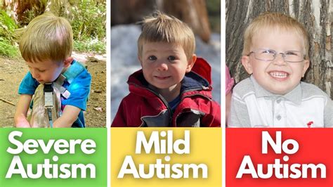 what is mild autism in 4 year old