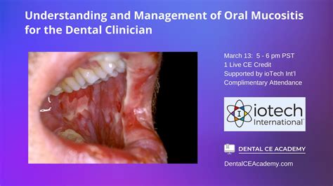 Understanding Mucositis: Causes, Symptoms, and Effective Treatment Options