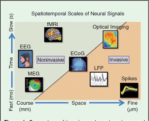 What Is Neural Signal Processing