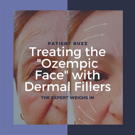 what is ozempic face swelling