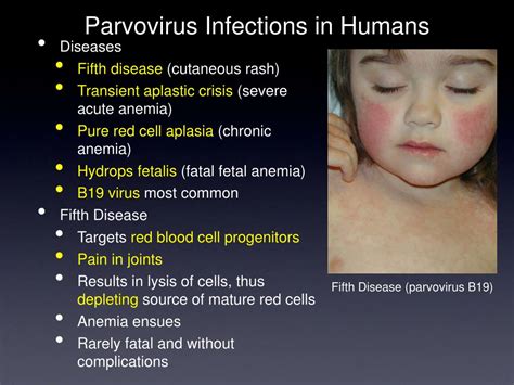 what is parvovirus b19 in humans