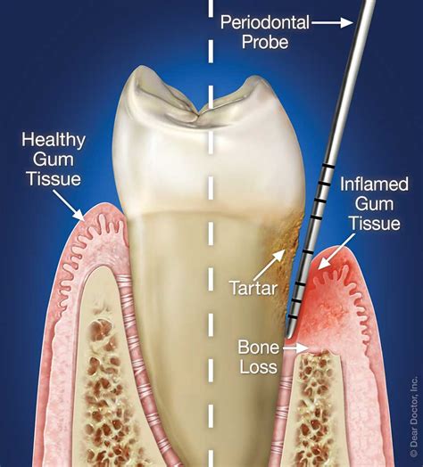 what is periodontic services dental