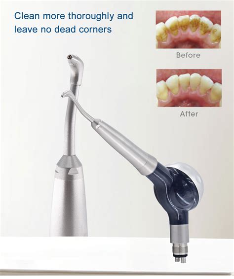 What Is Prophy Jet Cleaning