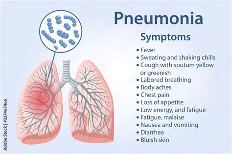 what is strep pneumonia symptoms