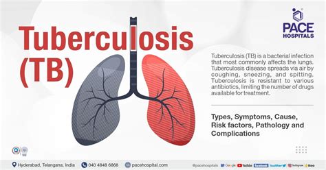 what is tb medical term