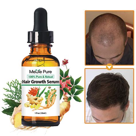 What Is The Best Treatment For Regrowing Hair 