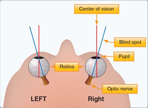 what is the blind spot in vision