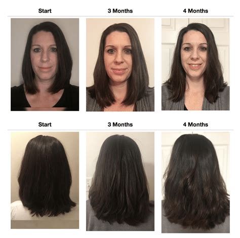 Free What Is The Maximum Hair Growth In A Month For Long Hair