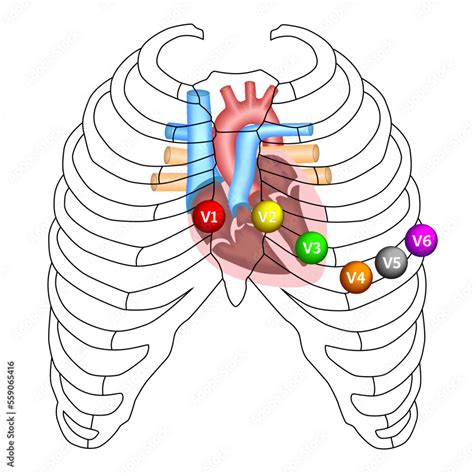 what is the meaning of v1 v2 v3 v4 in ecg